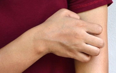 Antibiotics and Allergies