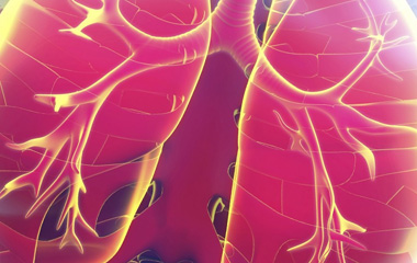 Chest Infections